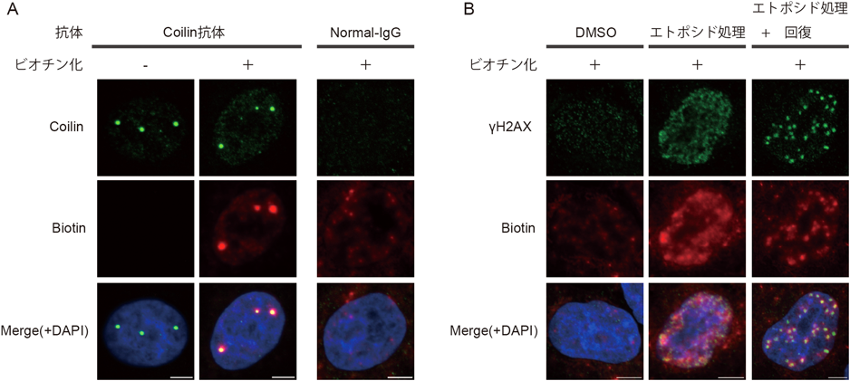 Journal of Japanese Biochemical Society 97(6): 858-862 (2025)